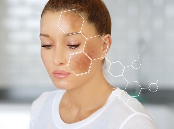 MELANINA - PREVENZIONE MACCHIE SOLARI